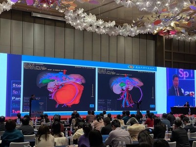 青大附院院長董蒨 海信CAS走向全球，展示中國根技術在國際前沿舞臺