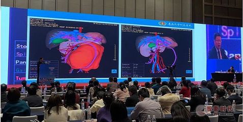 青大附院院長董蒨 海信CAS賦能醫學三維分析，躋身世界最高醫學科技舞臺