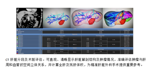 3D可視化技術 外科手術的“GPS”