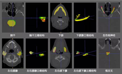 從頭頸部癌癥靶區勾畫入手,「邃藍智能」認為AI能解決的醫療痛點還有很多